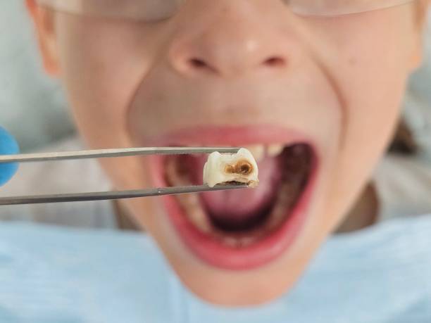 Best Emergency Denture Repair in Texanna, OK