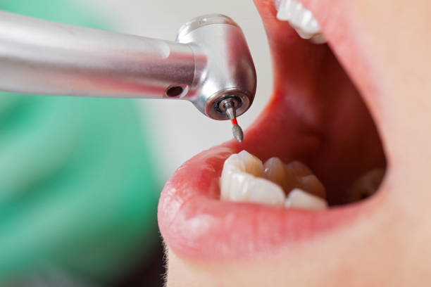 Best Emergency Treatment for Oral Infections in Texanna, OK